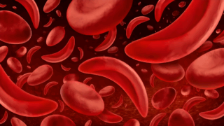 Pregnancy in Sickle Cell Disease: Addressing the Underrecognized Risk of Venous Thromboembolism