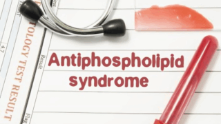 Antiphospholipid Syndrome (APS) in Pregnancy - Key Takeaways