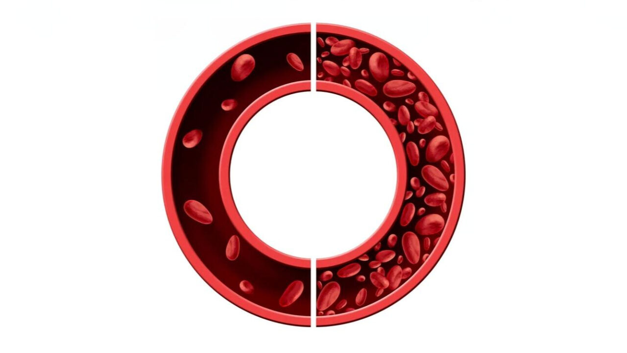 Iron Deficiency in Heart Failure: Mechanisms and Pathophysiology