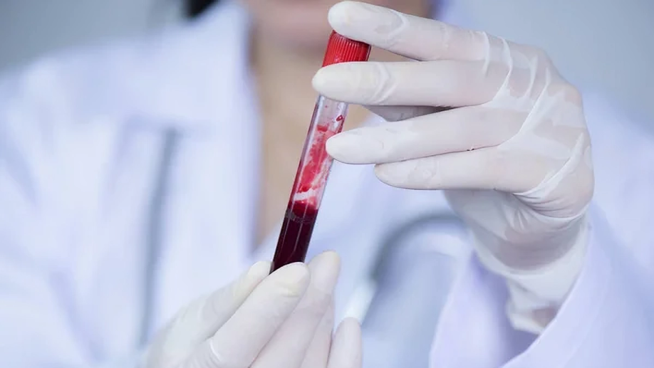 Grifols Supports International ITP Awareness Week: Understanding Immune Thrombocytopenia