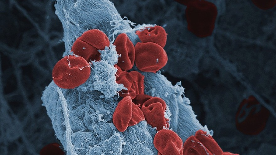 Professor Beth Psaila: Platelets are Acting as Sentinels in the Blood