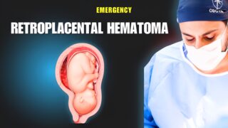 Dr Wael El Banna: How A Retroplacental Hematoma Looks Like In A Surgery Room