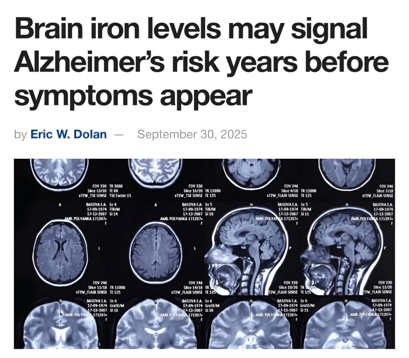 Alzheimer’s risk