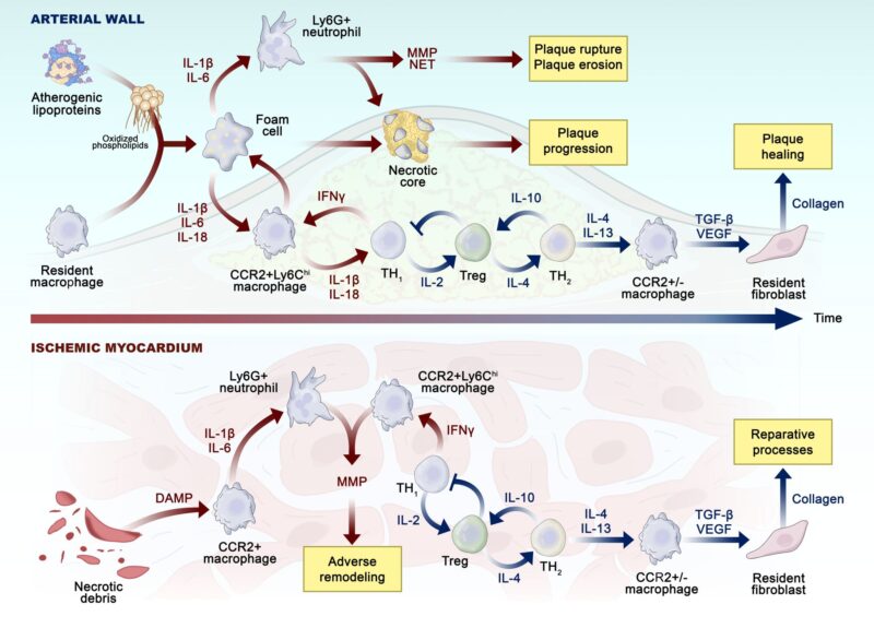 Claudio Laudani: We Summarize Current Knowledge and Future Perspectives On The Role of Inflammation in Patients with MI