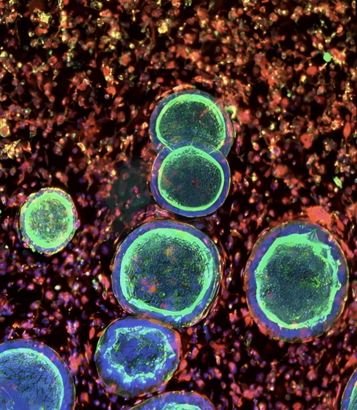 Lukas Gaats: Researchers Are Building Reproductive Organoids 1 Lukas Gaats