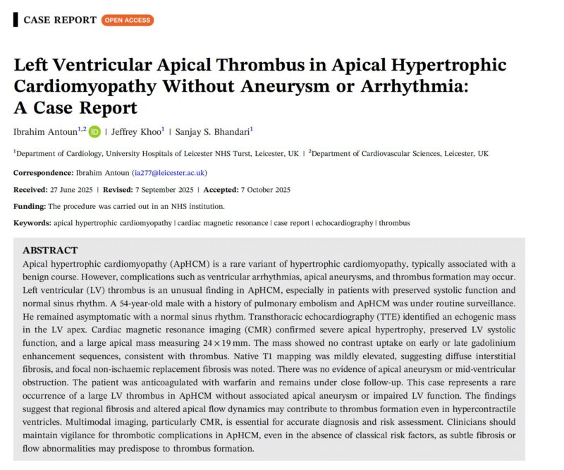 Ibrahim Antoun Describes LV Thrombus of Unknown Origin in Apical HCM