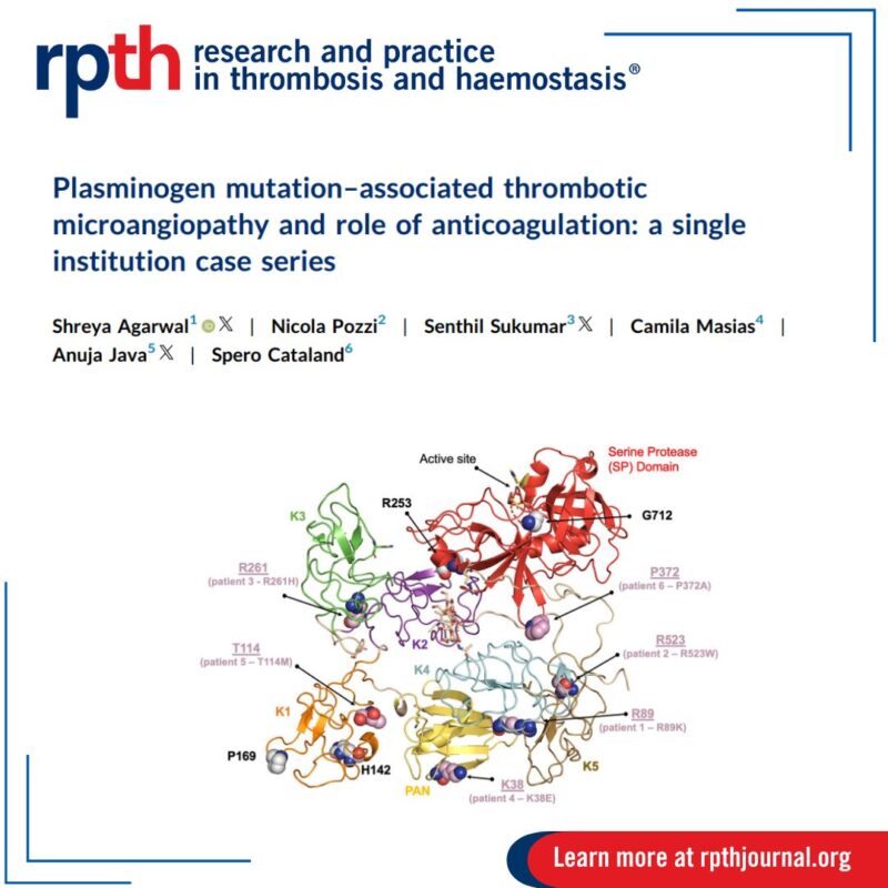 Shreya Agarwal: We Describe Patients With PLG Mutations Who Experienced Recurrent TMA
