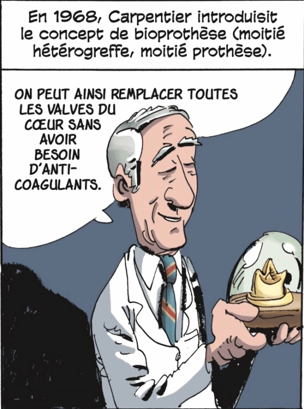 Mechanical Valves