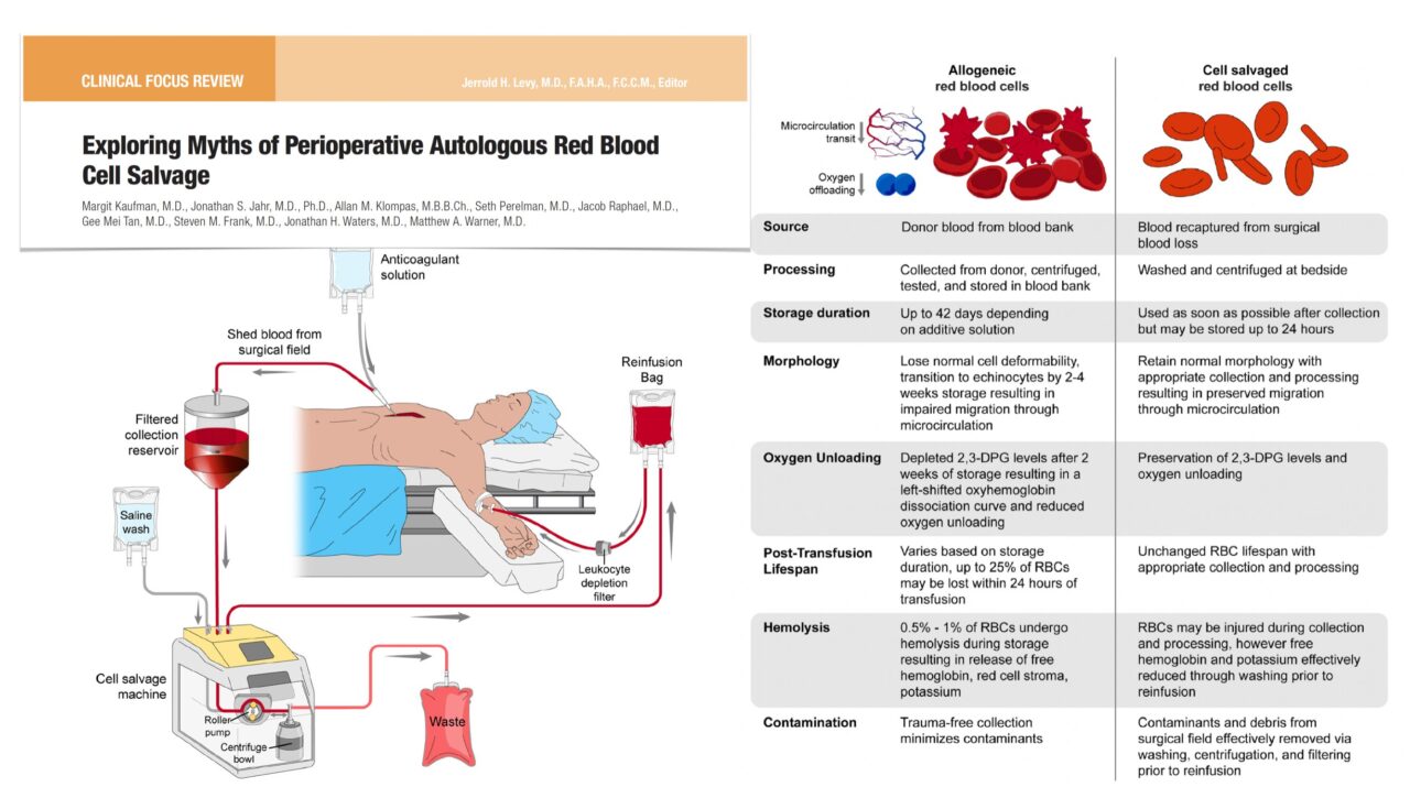 Marta Velia Antonini: Myth-Busting on Perioperative Autologous Red Blood Cell Salvage