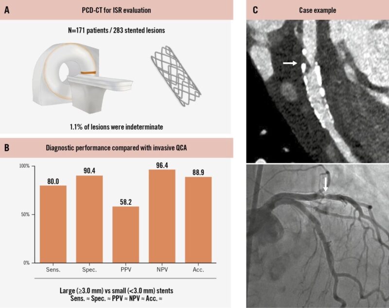 Michael Hadley: Photon-Counting CT Offers Good Diagnostic Accuracy for Detecting In-Stent Restenosis