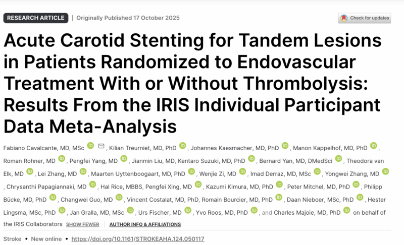 Fabiano Cavalcante on Stenting of Stroke Patients with Tandem Carotid Lesions