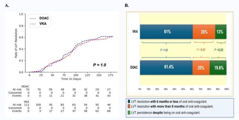 Hossam Elbenawi on Comparison of DOACs and VKAs in the Treatment of Left Ventricular Thrombi