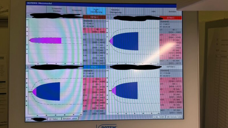 Benedikt Lorenz on Liver Failure and Coagulation – Myths, Traps, and Bad Habits 1 Benedikt Lorenz on Liver Failure and Coagulation – Myths, Traps, and Bad Habits