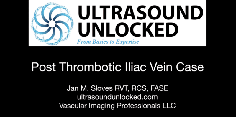 Post-Thrombotic