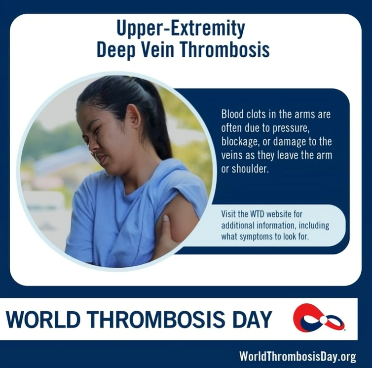 Thrombosis