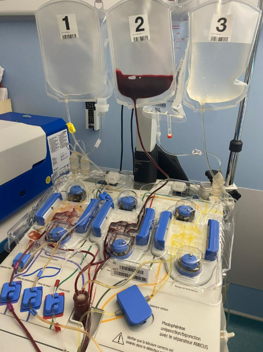 Extracorporeal photopheresis