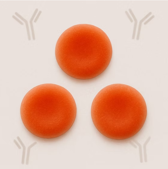 Warm Autoantibodies