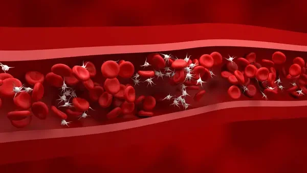Asmaa A About Pseudo Thrombocytopenia: Causes and How to Handle 