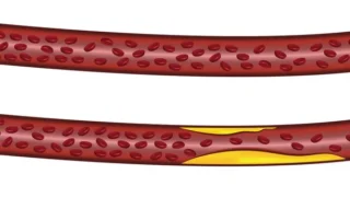 Enzymatic Modifications of Protein S: Implications for Diagnostics and Anticoagulant Function