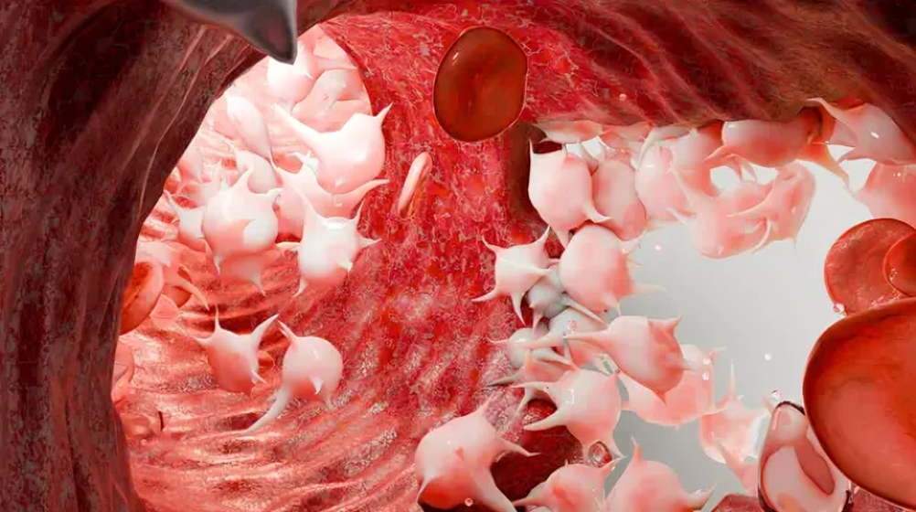 Ritu Upadhyay: Hematology Is a World of Stories Hidden in Every Drop of Blood