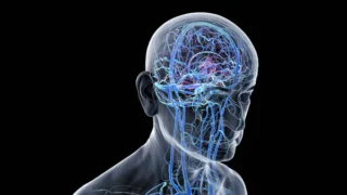 Cavernous Sinus Thrombosis – a Rare, Life-Threatening Clot in the Venous Sinus at the Skull Base