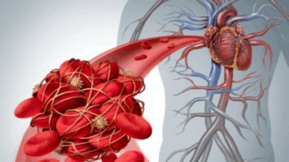 Wilfried Dinh: Top 10 Thrombosis And Antithrombotic Therapy Papers Of 2024