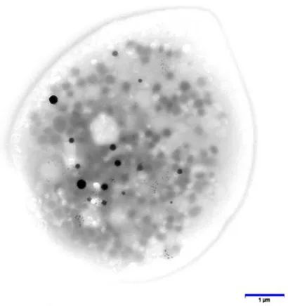 Steven Murphy Highlights New Research Linking POTS Platelets to Storage Pool Deficiency