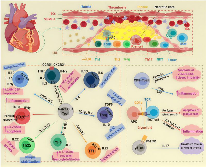 Atherosclerosis
