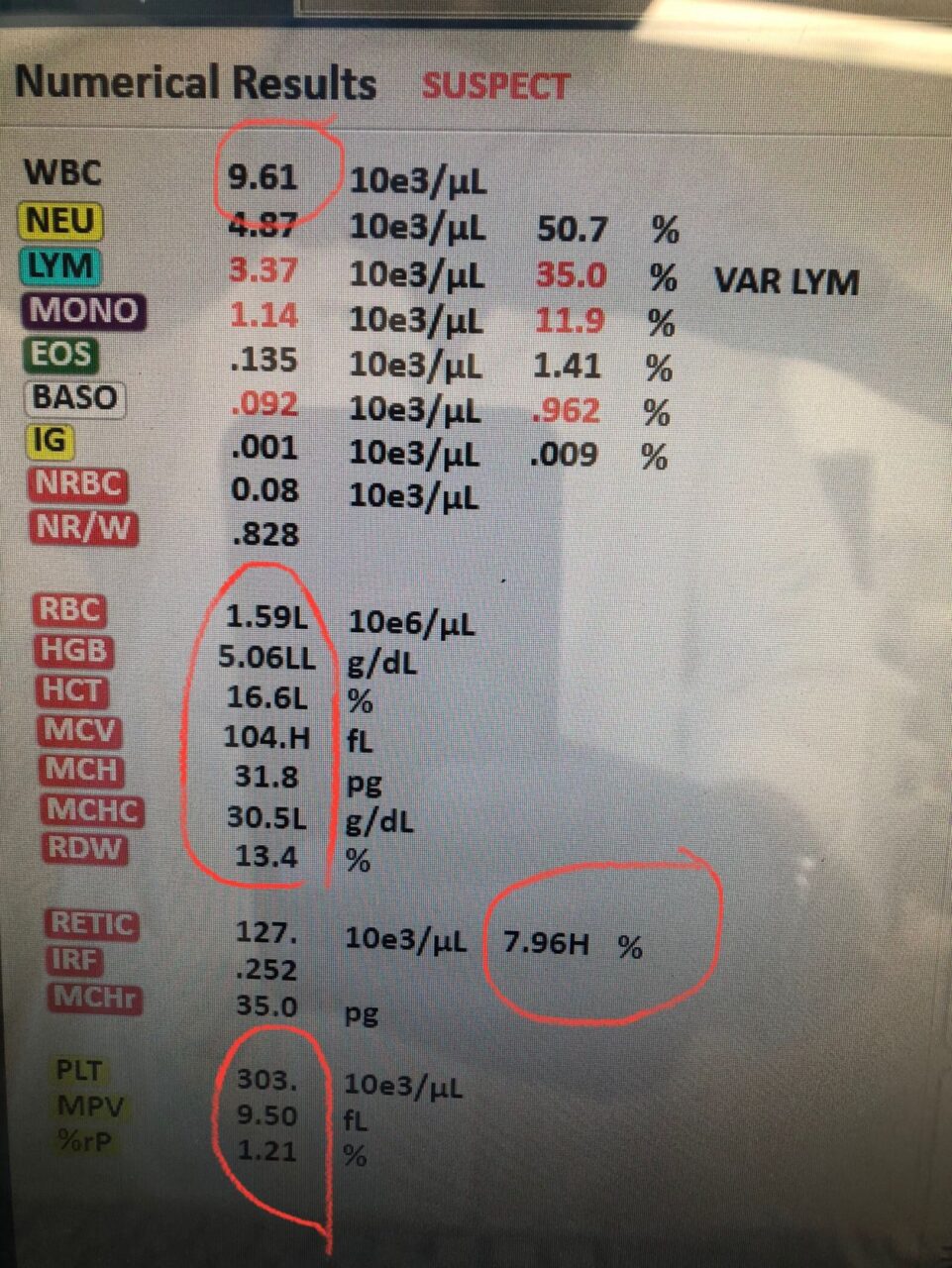 Abdulaziz (Omar) Badran: Our Case Contain Very Strange and Rare Combination of 2 Causes of Hemolytic Anemia