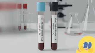 Sodium Citrate 1:9 vs 1:4 - Key Lab Tip for Accurate Results