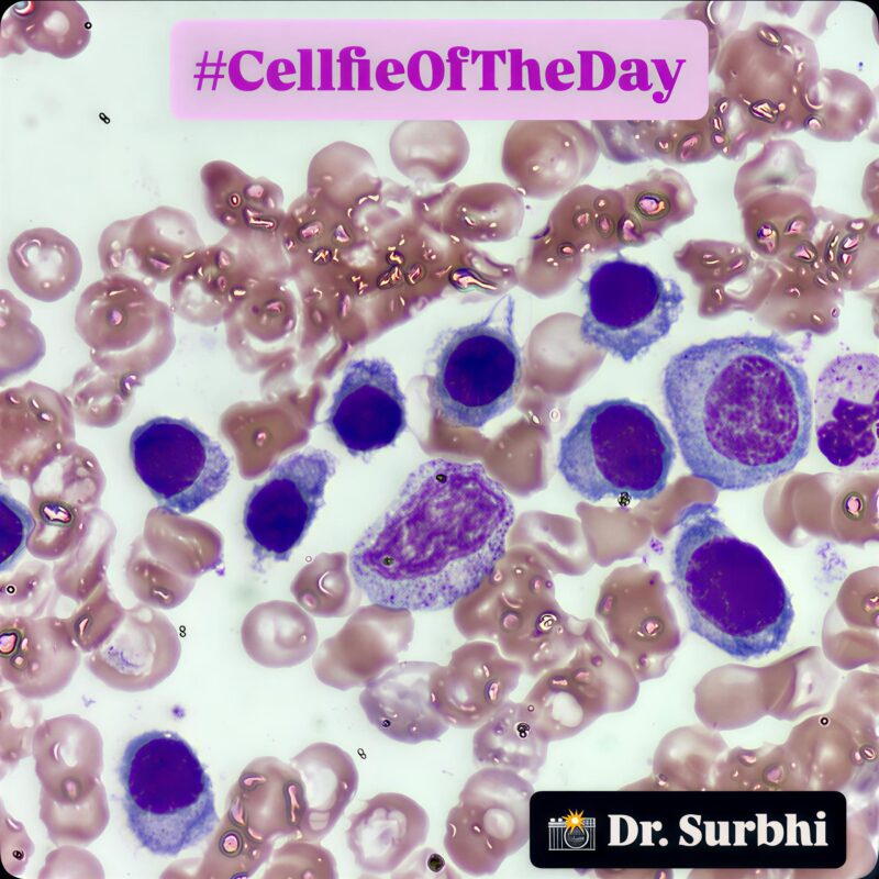 Cellfie of The Day