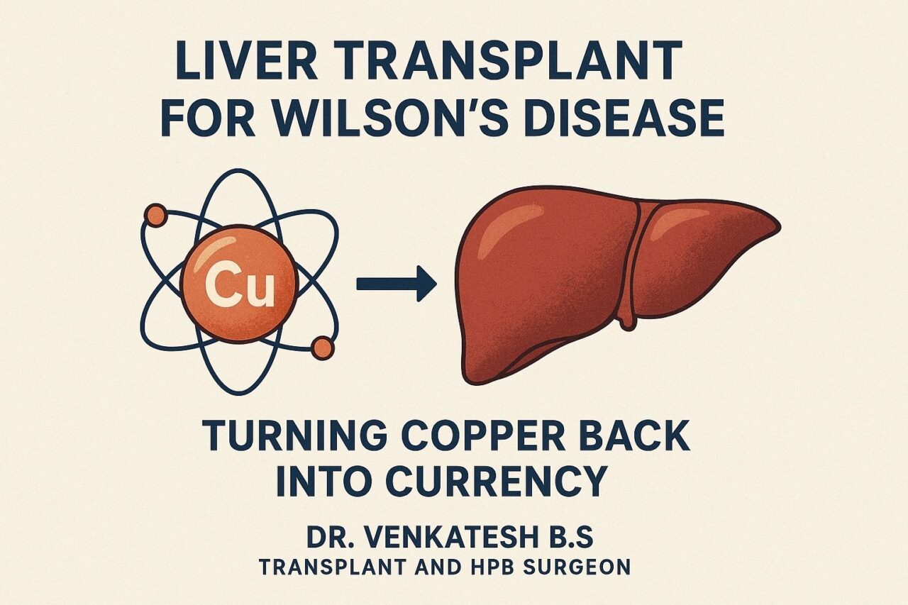 Dr Venkatesh on Liver Transplant for Wilson's Disease: A Metabolic Cure