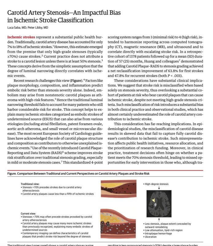 Luca Saba on Carotid Artery Stenosis—An Impactful Bias in Ischemic Stroke Classification