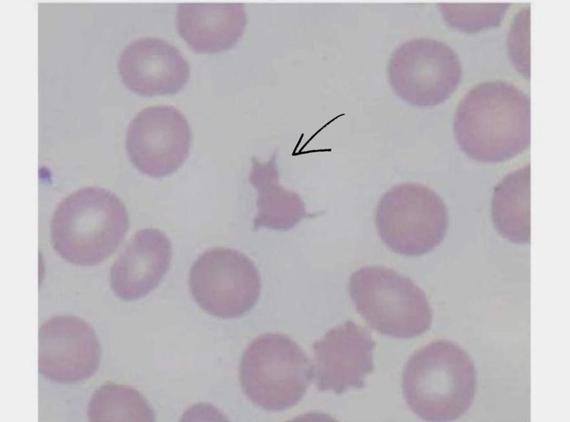 A ''Meow-cyte'' from Melaku Abay Muluneh or Why Microscopy Never Gets Old! 1 A ''Meow-cyte'' from Melaku Abay Muluneh or Why Microscopy Never Gets Old!