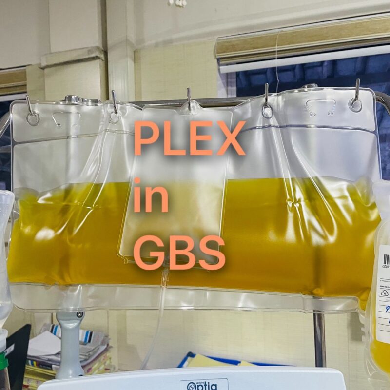 Priya Prasad on Therapeutic Plasma Exchange in Guillain–Barré Syndrome