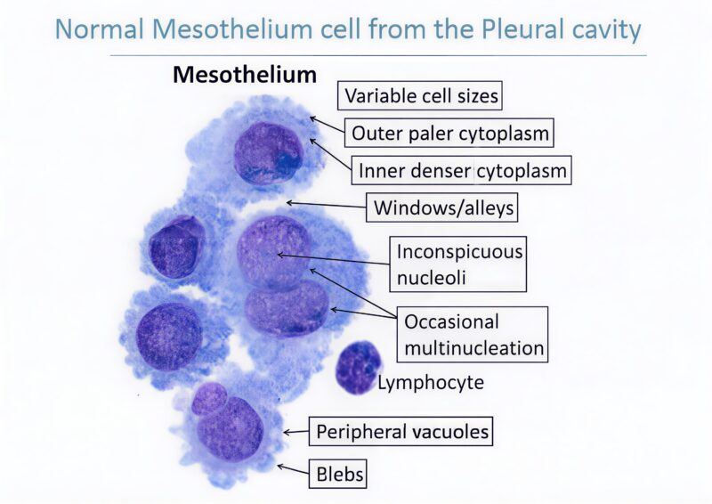 Mesothelial Cells