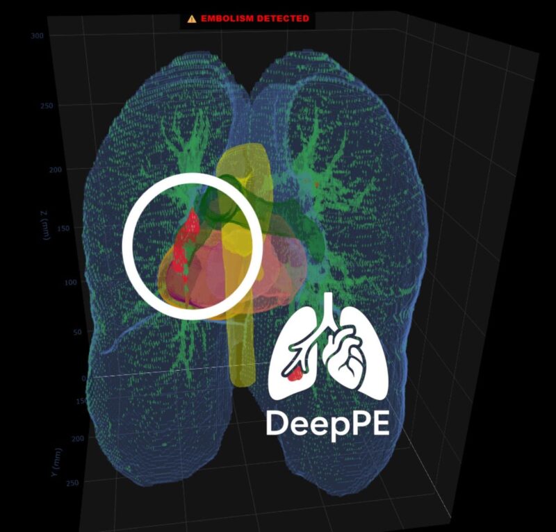 Amir Mohammad Nouri on The Potential of DeepPE 1 Amir Mohammad Nouri on The Potential of DeepPE