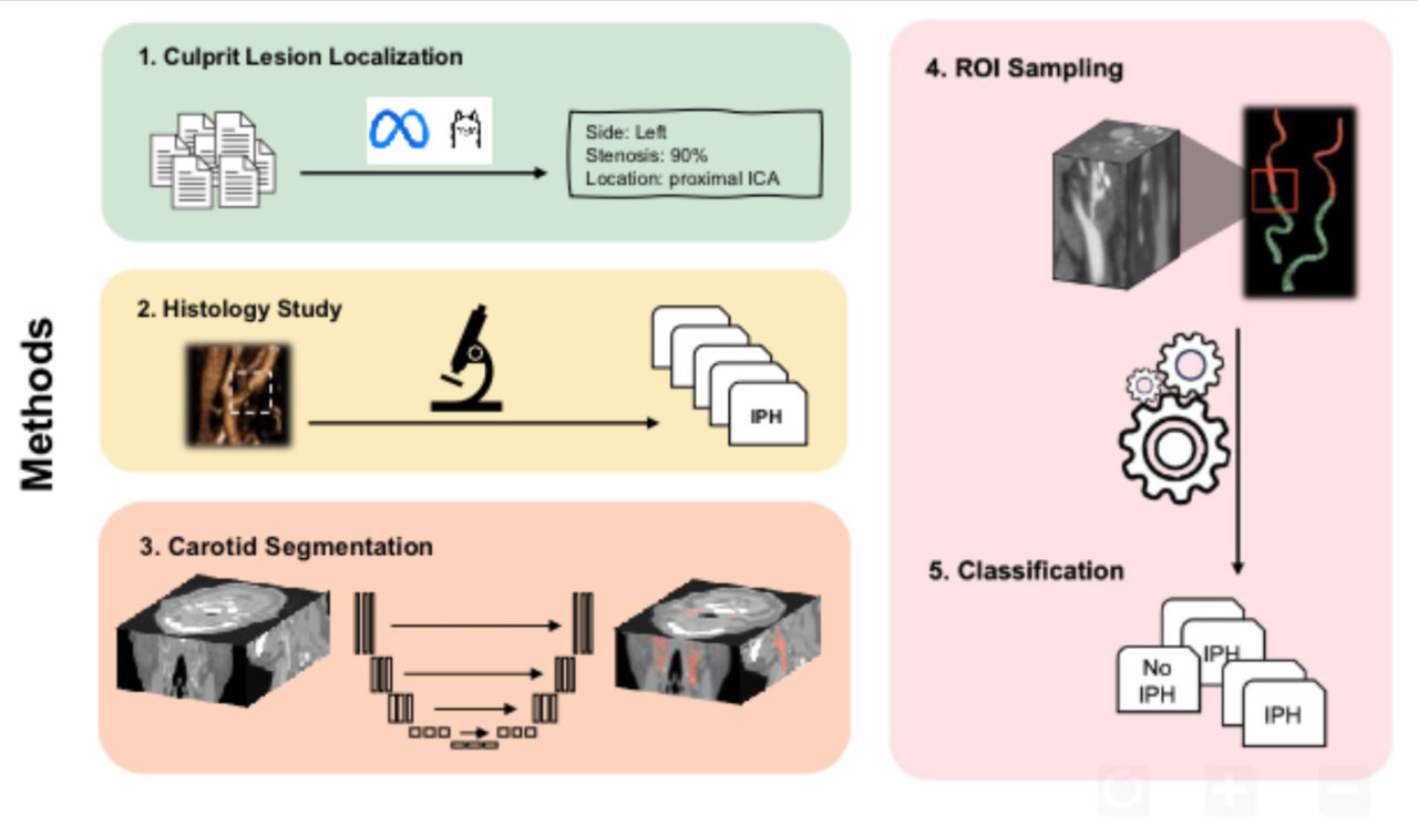 Elham Mahmoudi Presents Artificial Intelligence in Imaging and Multimodal Biomarkers