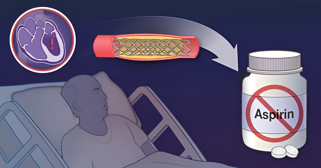 NEJM Quick Take: Is Early Aspirin Withdrawal Safe After PCI?