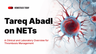 Tareq Abadl on NETs: A Clinical and Laboratory Overview for Thrombosis Management