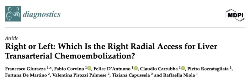 Francesco Giurazza on Radial Access for Liver Transarterial Chemoembolization