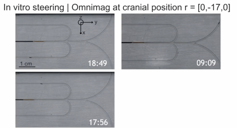 Mohamed Aly Saad Aly on Microcatheters for Superselective Arterial Embolization 1 Mohamed Aly Saad Aly on Microcatheters for Superselective Arterial Embolization
