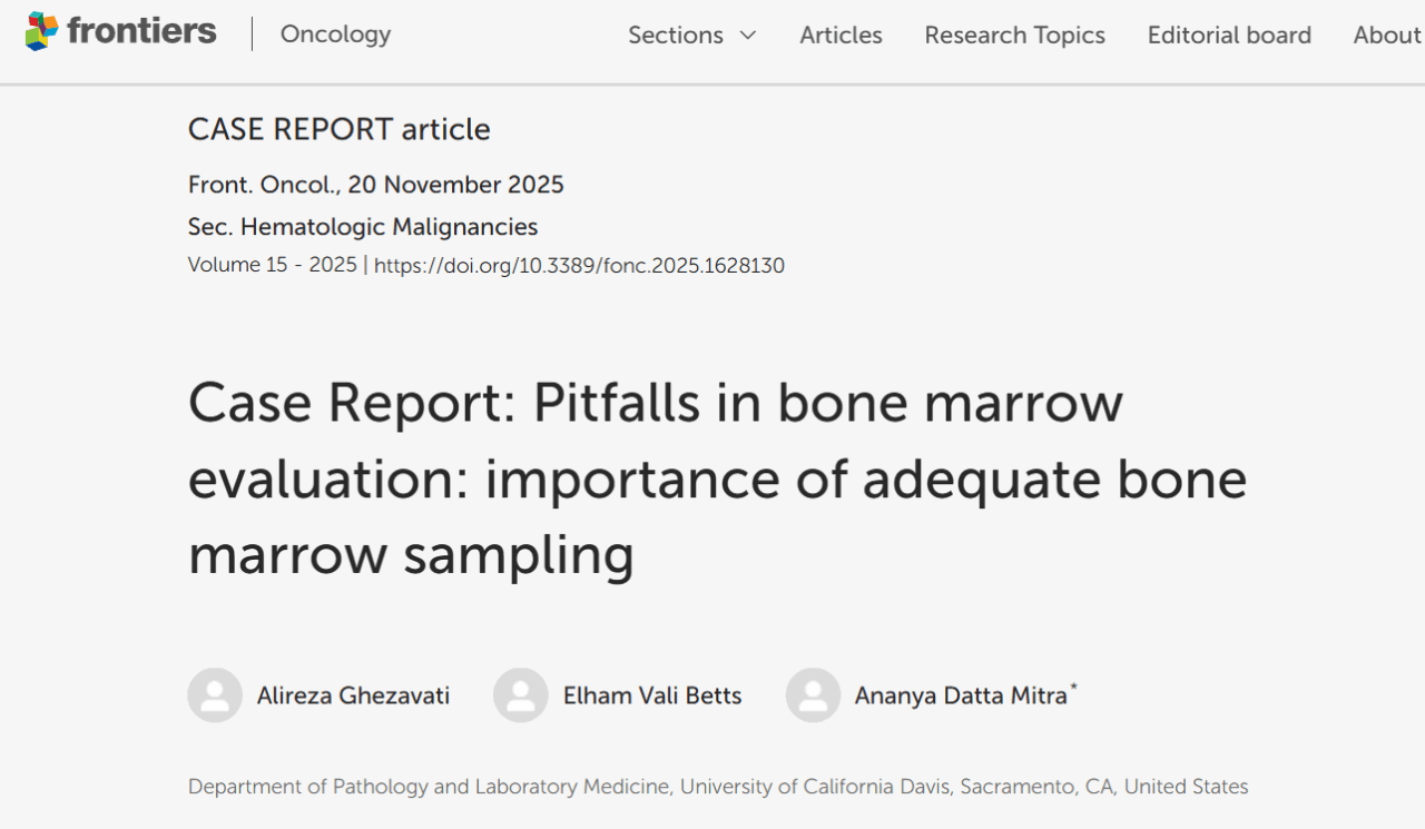 Hassan Raza: Importance of Adequate Bone Marrow Sampling 1 Hassan Raza: Importance of Adequate Bone Marrow Sampling