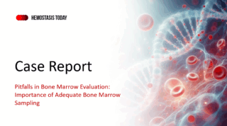 Hassan Raza: Importance of Adequate Bone Marrow Sampling