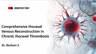 Dr. Resham S.: Comprehensive Iliocaval Venous Reconstruction in Chronic Thrombosis