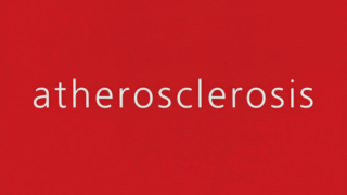Atherosclerosis - How Much Does Fitness Really Add to Cardiovascular Risk Assessment?