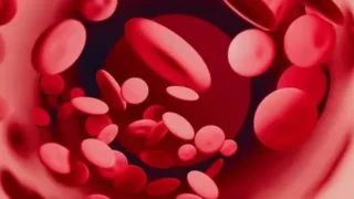 Hassan Raza: Machine Learning for Predicting Thrombotic Recurrence in Antiphospholipid Syndrome