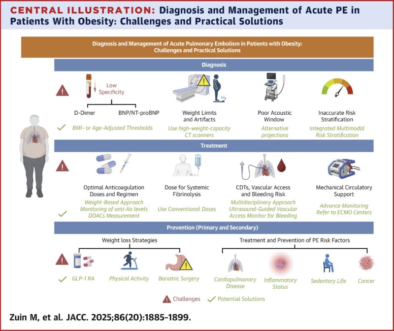 Obesity-Linked Gaps in Pulmonary Embolism Management - Shared by Zain Khalpey 1 Pulmonary Embolism