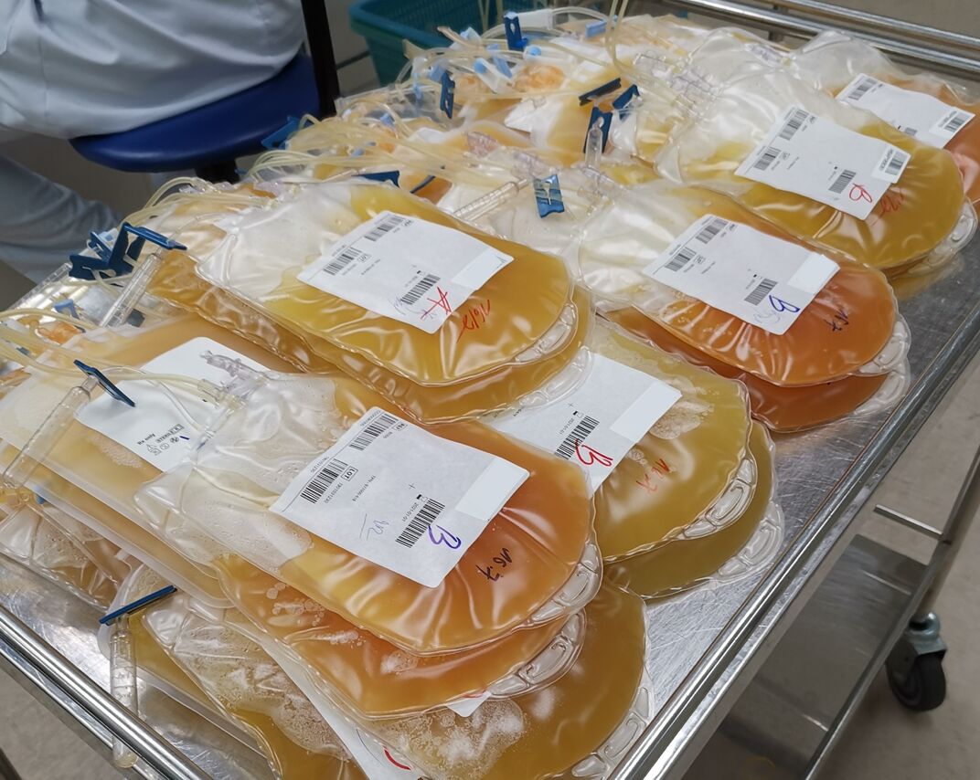 Maxime Dely on a Hopeful Horizon: Promising Advances in Extending Platelet Power 1 Maxime Dely on a Hopeful Horizon: Promising Advances in Extending Platelet Power