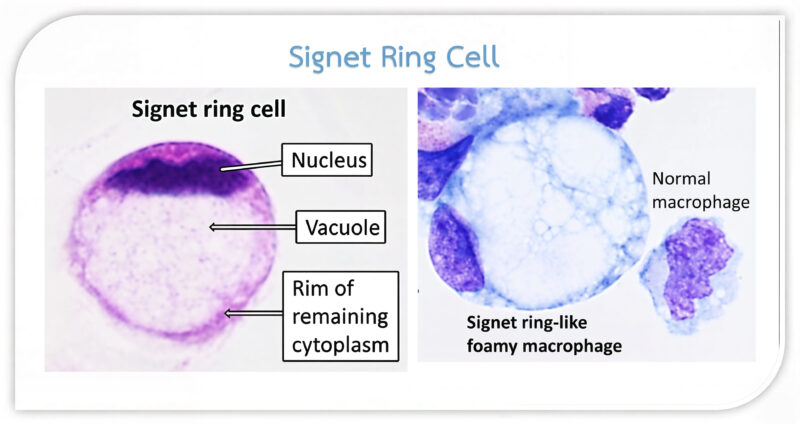 Ring Cells